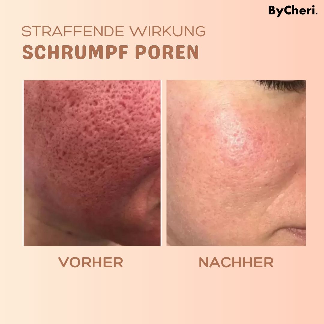 RadianceRewind™ — Instantly Smooth Away Wrinkles for a Radiant, Youthful Glow