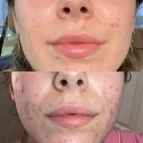 RadiantRay™ — Transform Your Skin with Spa-Quality Glow Anytime, Anywhere