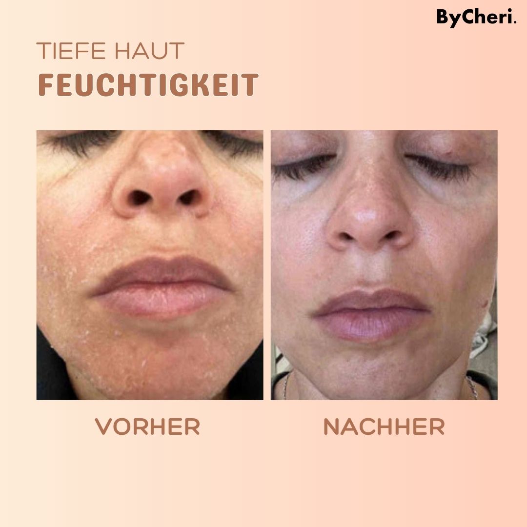 RadianceRewind™ — Instantly Smooth Away Wrinkles for a Radiant, Youthful Glow