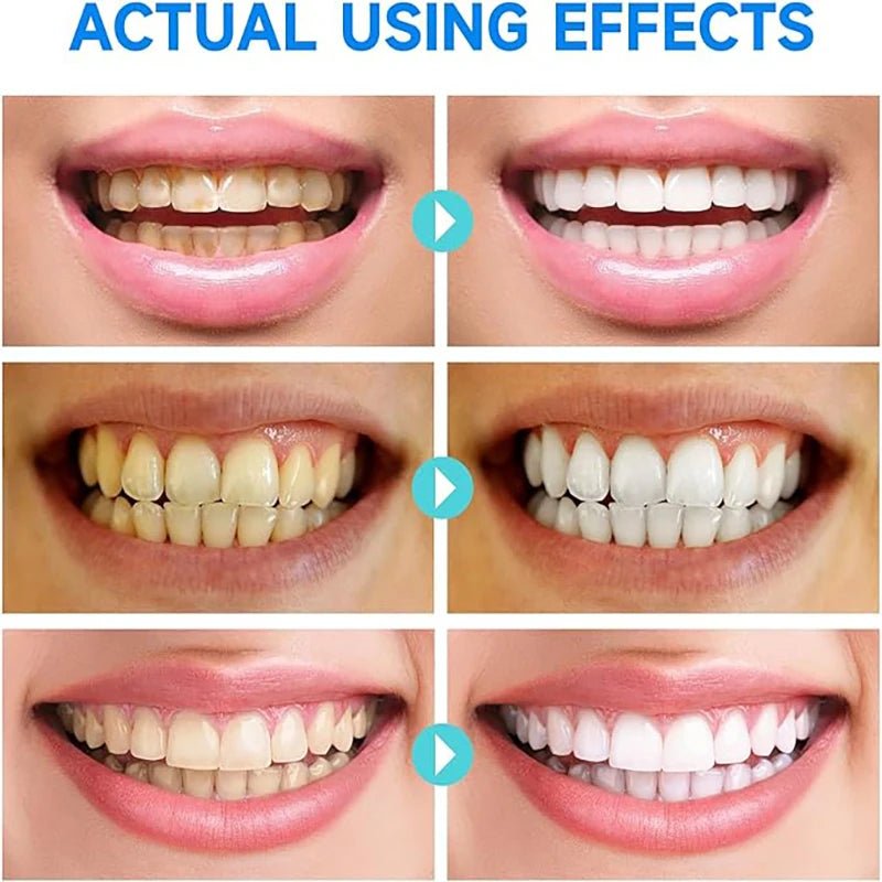 BrightMist™ — Transform Your Smile with Soothing Care and Instant Confidence