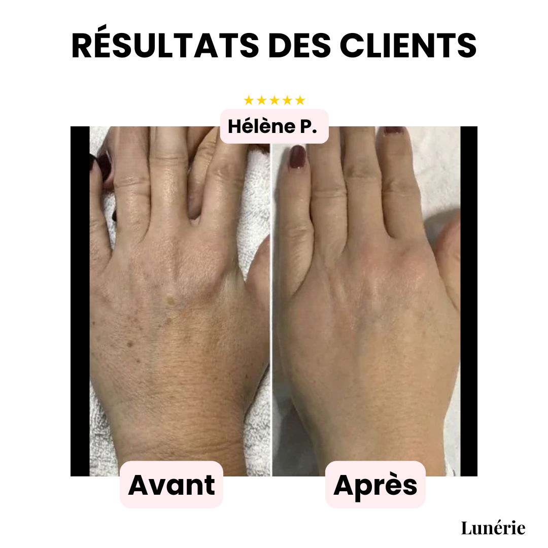 SilkVeil™ — Reveal Radiant, Flawless Skin That Lasts for Days