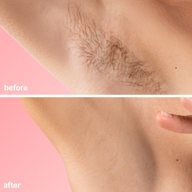 BareBasic™ No-Shave Hair Removal Cream — Smooth, Silky Skin in Minutes Without the Pain or Irritation