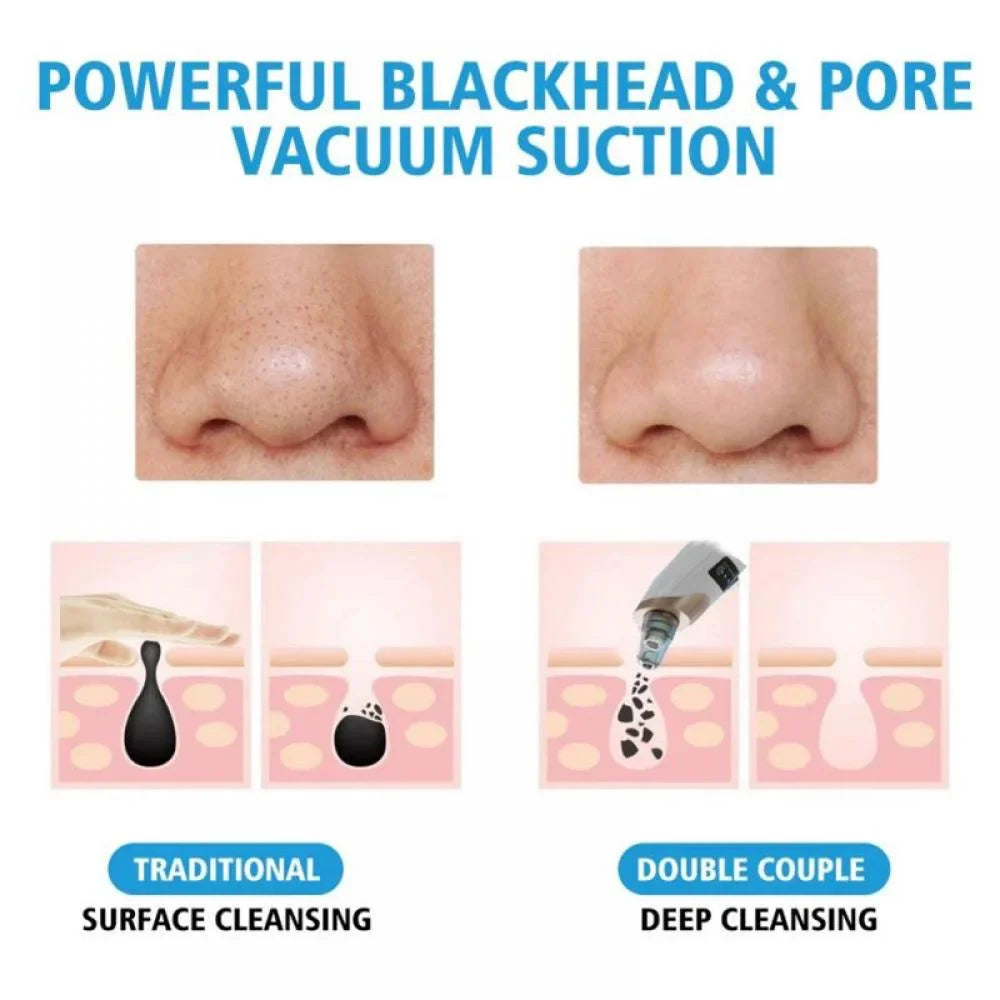 DermalPure™ Pro — Instantly Unleash Smooth, Shine-Free Confidence