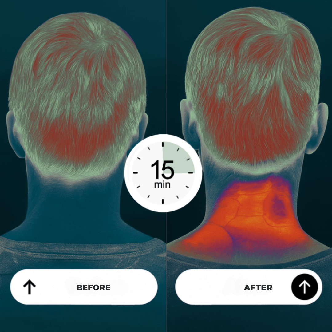 ChillNeck™ Wrap — Melt Away Neck Pain Instantly and Own Every Moment