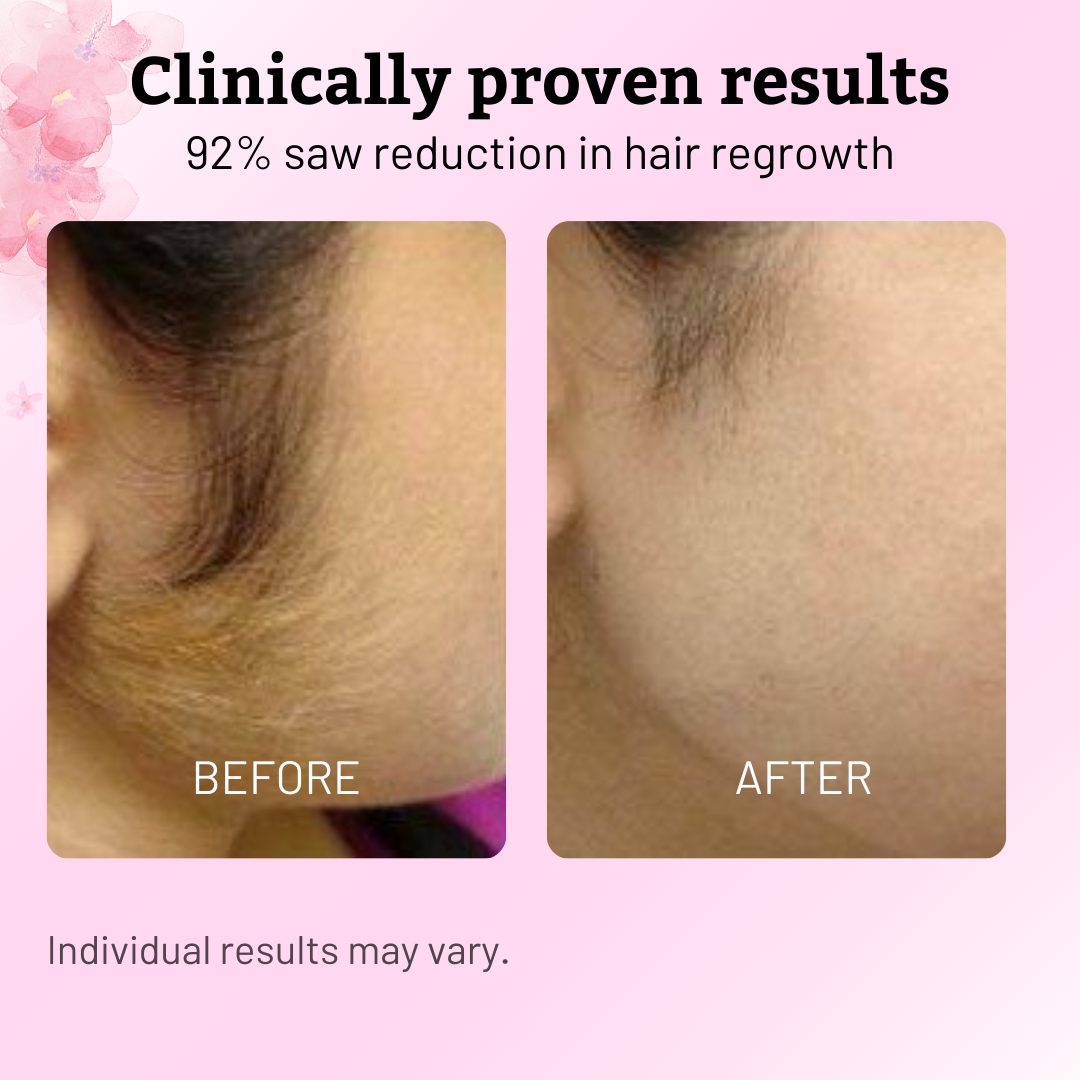 SilkaPure™ — Experience Pain-Free Softness and Watch Hair Retreat in Just One Week