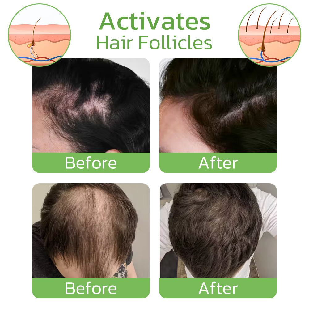 RevitaRoot™ Invigorating Ginger Spray — Ignite Dormant Follicles for Thicker, Younger-Looking Hair Fast