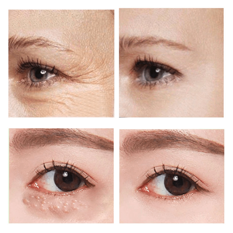 EyeVerra™ — Smooth Away Wrinkles Instantly for Youthful, Radiant Eyes