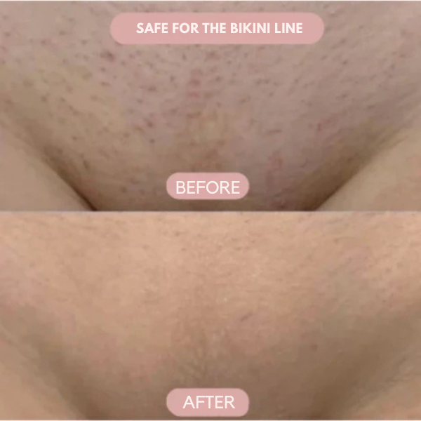 VelvetGlide™ — Enjoy Silky, Bump-Free Skin Without a Single Cut or Irritation