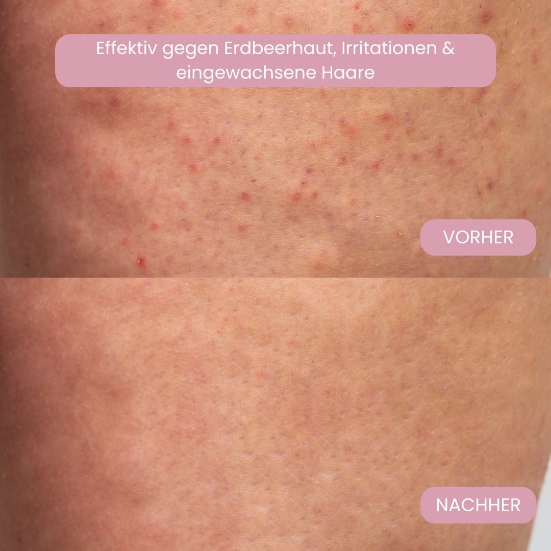 SilkenSmooth Women's Electric Trimmer for Delicate Areas