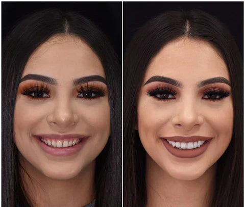 Transform Your Smile Instantly with Custom Fit Veneers