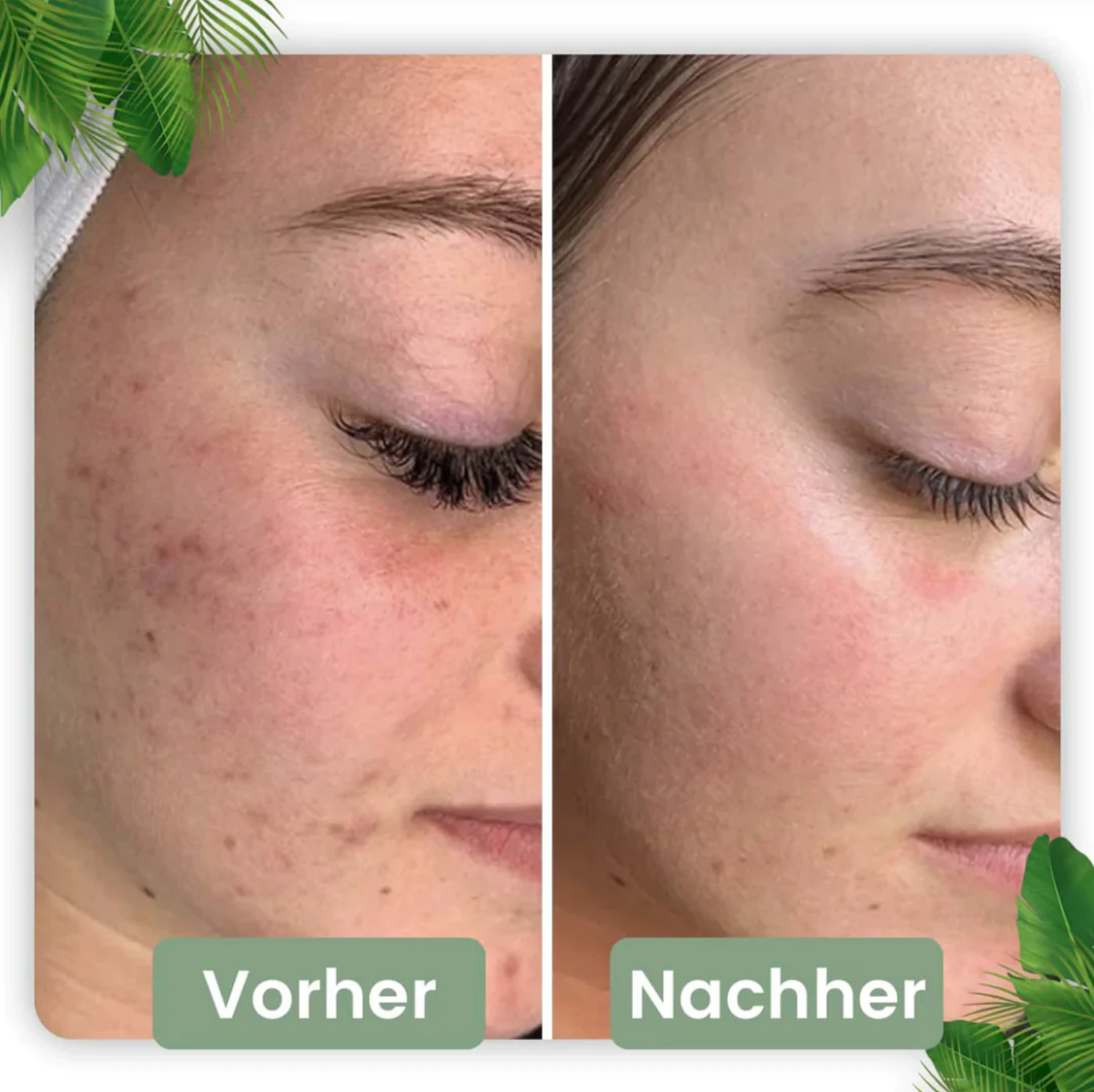 Deep Clean Stick for Radiant Skin | Natural Green Tea Infusion