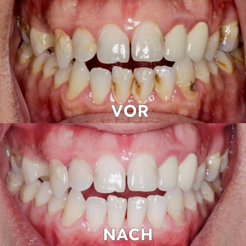 Natural Mineral Powder for Dental Care | Strengthen & Protect Your Smile