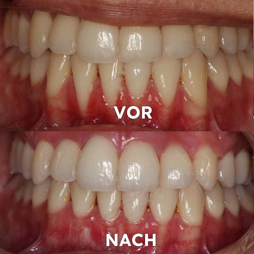 Natural Mineral Powder for Dental Care | Strengthen & Protect Your Smile