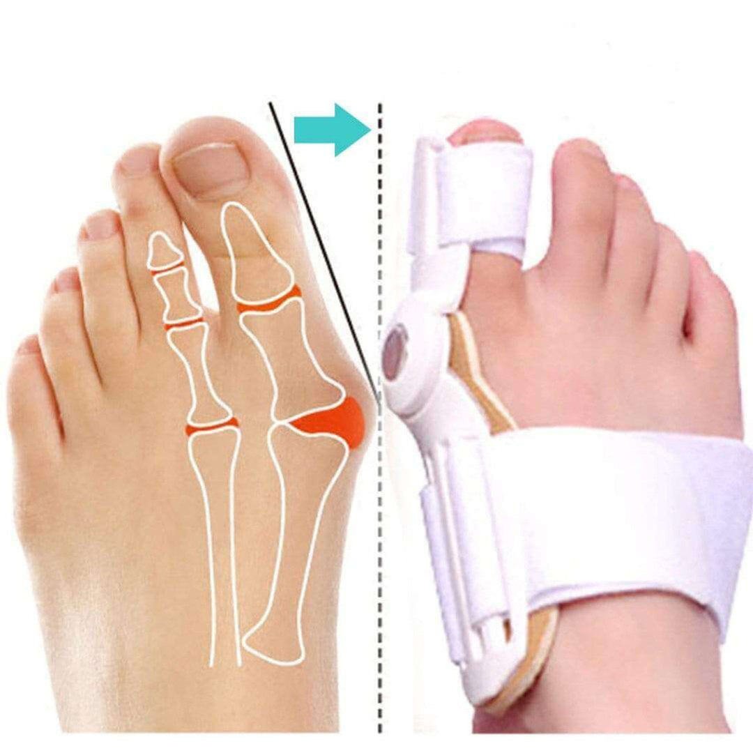 FlexiStep™ Toe Stabilizer — Pain-Free Steps and Confident Feet Every Day