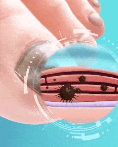 MycoClear™ Nail Rescue Pen — Clear, Confident Nails in Just 24 Hours