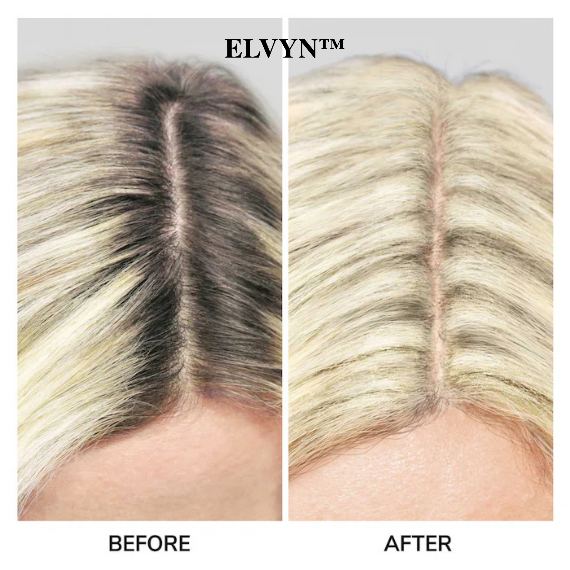 VeilLuxe™ — Instantly Reclaim Your Youthful, Full-Bodied Hair Confidence