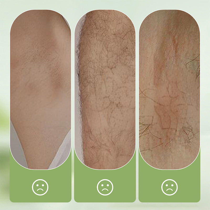 Velvett™ — Unlock Silky, Smooth Skin Without Pain or Stubble