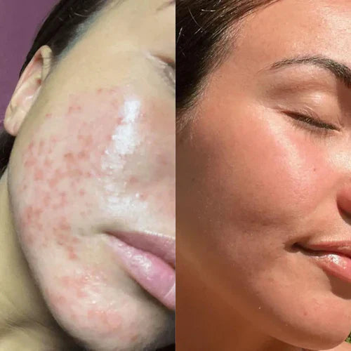 LumiLuxe™ — Unlock Your Glow with Youthful, Radiant Skin Every Day