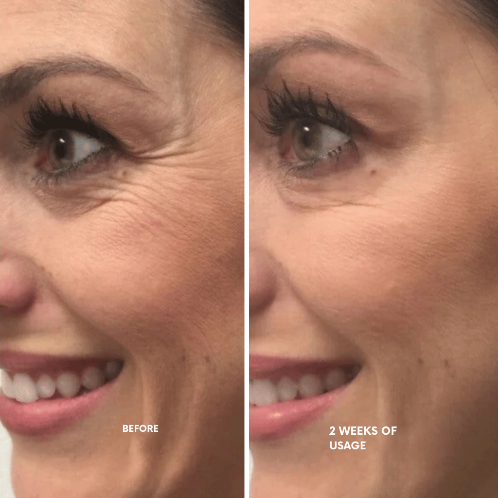 RadianceLift™ — Unleash Youthful Glow and Firm, Silky Skin in Just Two Weeks