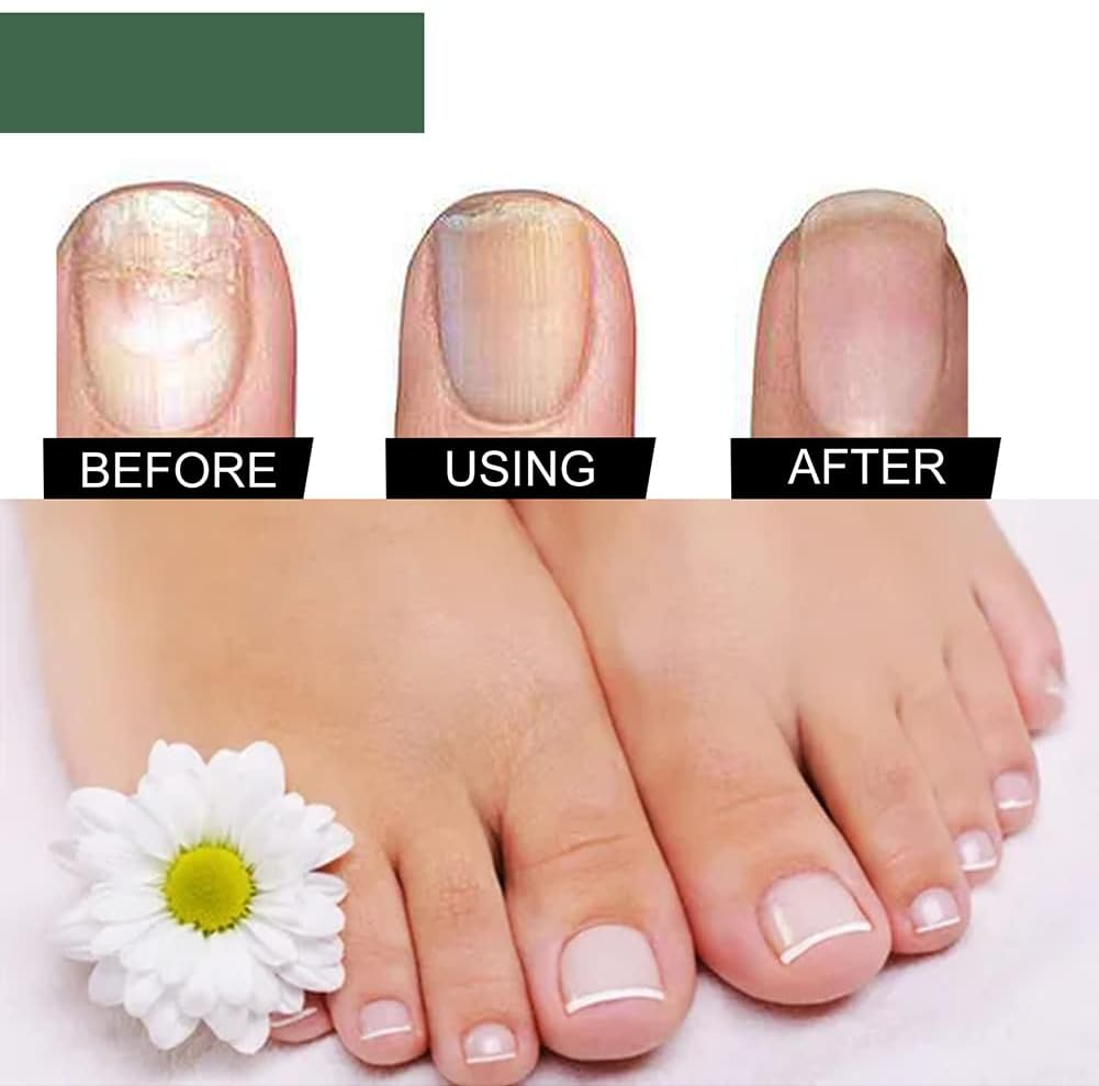 ClearStep™ — Step Confidently with Clear, Strong Nails That Demand Attention