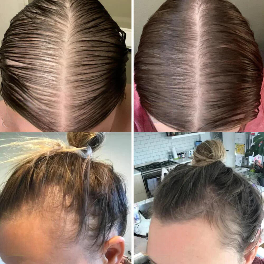 ElevaVive™ — Unlock Rich, Full-Bodied Hair That Commands Attention