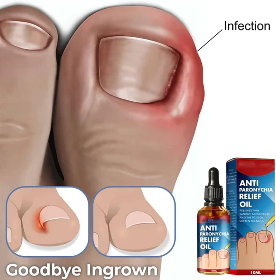 NailVita™ — Unlock Unbreakable Nails That Turn Heads Every Day