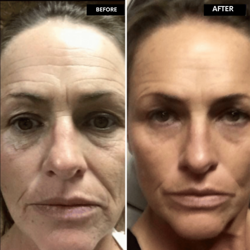 RadianceLift™ — Unleash Youthful Glow and Firm, Silky Skin in Just Two Weeks