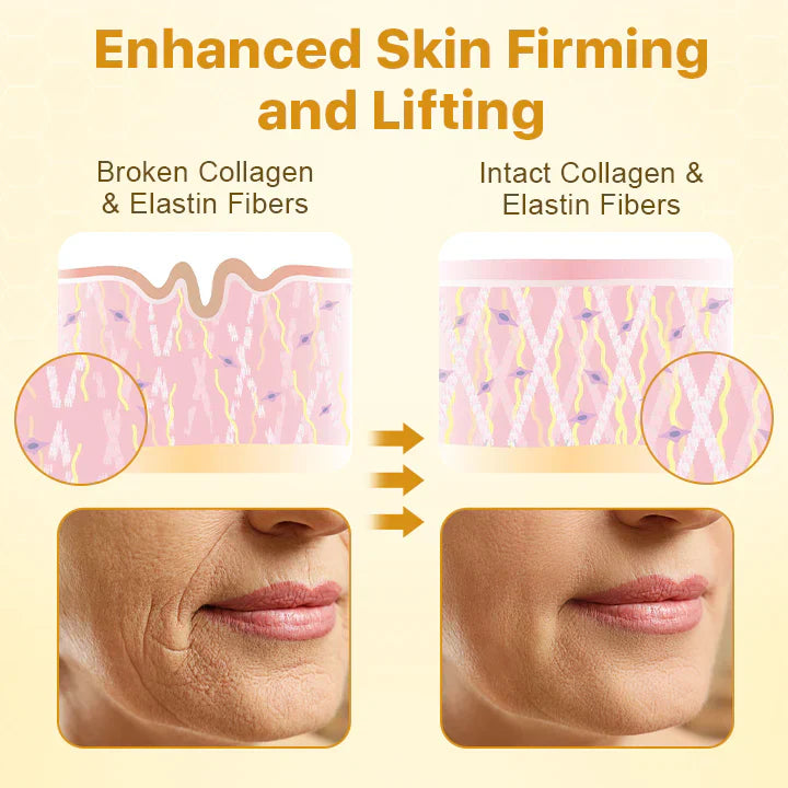 Buy One Get One Free Today | Botox Treatment