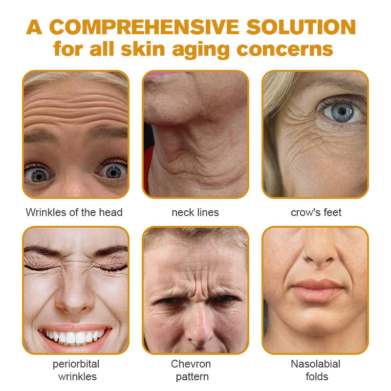 Buy One Get One Free Today | Botox Treatment