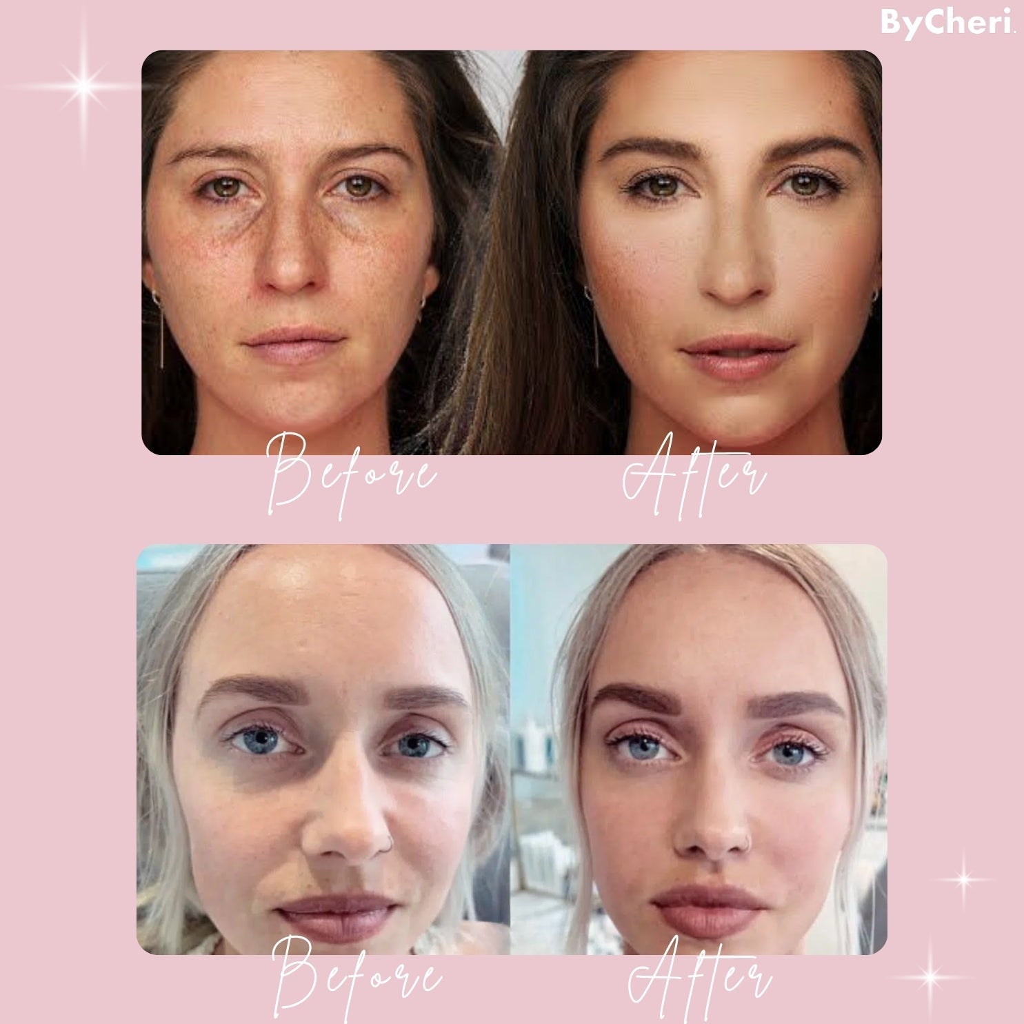 Buy One Get One Free Today | Brightening Eye Cream for Dark Circles