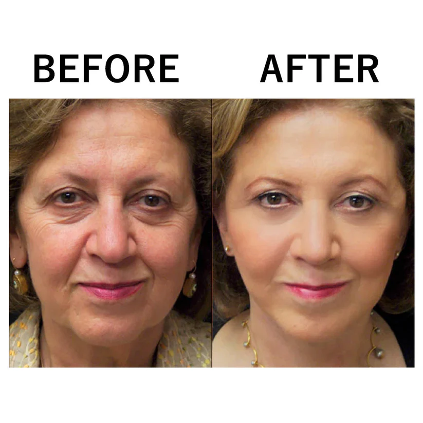 Buy One Get One Free Today | HydraLift