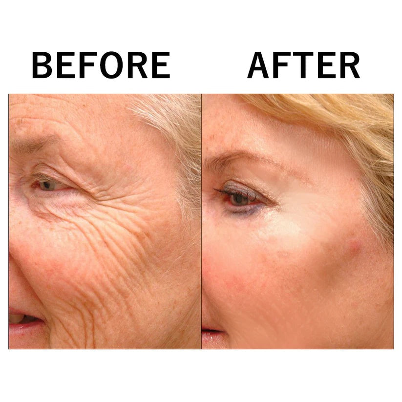 Buy One Get One Free Today | HydraLift