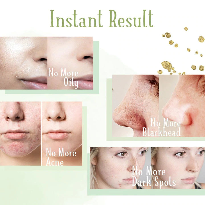 Buy One Get One Free Today | Green Tea Pore Cleansing Stick
