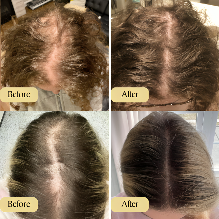 Buy One Get One Free Today | Enjoy Beautiful & Healthy Hair!