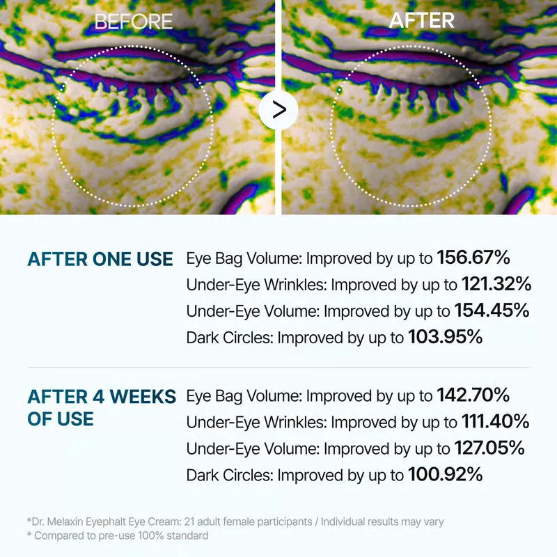Buy One Get One Free | Firming Eye Treatment for Tired Eyes, Reveals Youthful Radiance