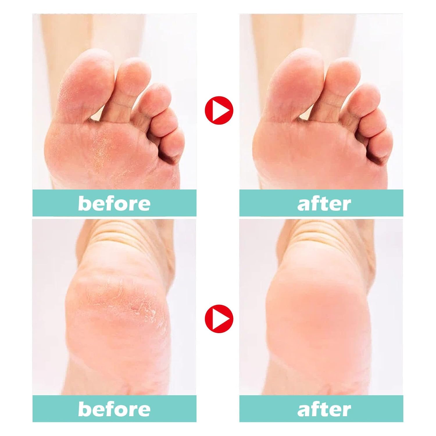 Buy One Get One Free | Foot Care Cream for Cracked Skin Relief