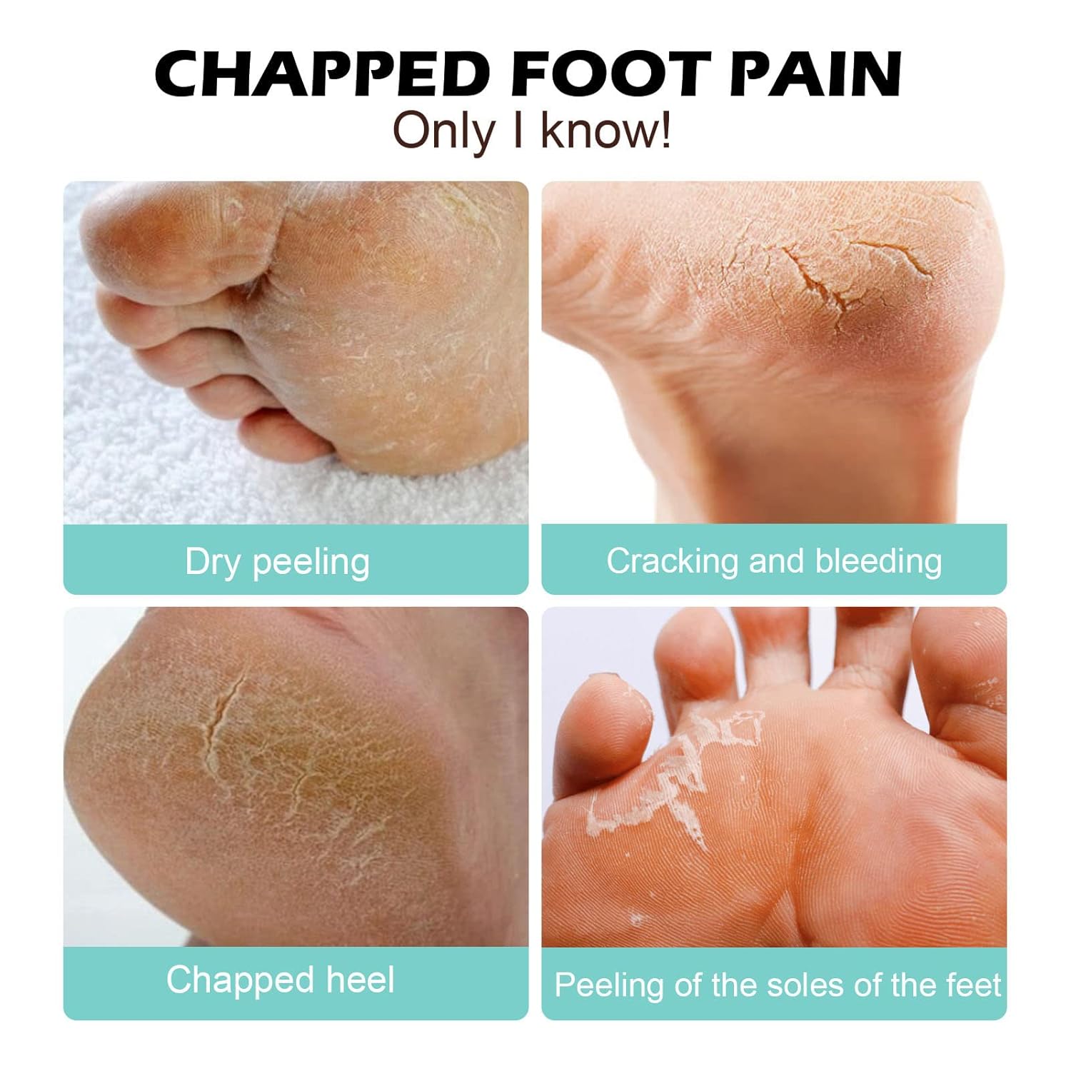 Buy One Get One Free | Foot Care Cream for Cracked Skin Relief