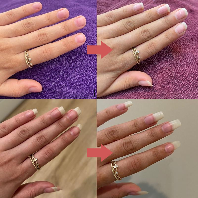 Buy One Get One Free | Nutritional Nail Growth Oil for Stronger, Healthier Nails