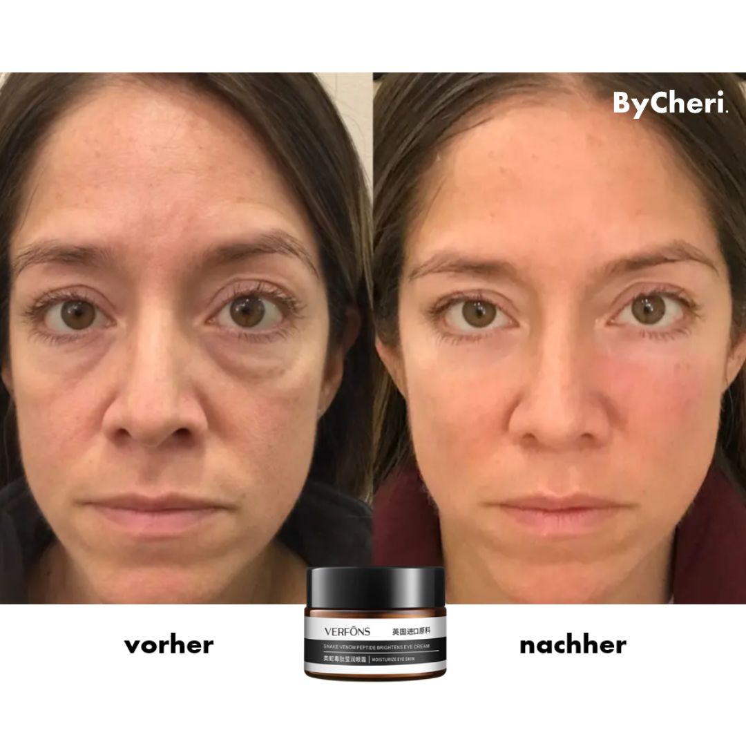 Buy One Get One Free | Anti-Wrinkle Eye Cream for Rejuvenation