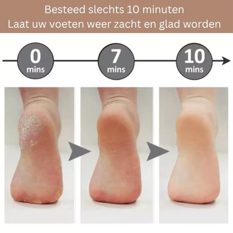 HyperSoothe™ — Unlock Silky, Pain-Free Feet That Boost Your Confidence Instantly