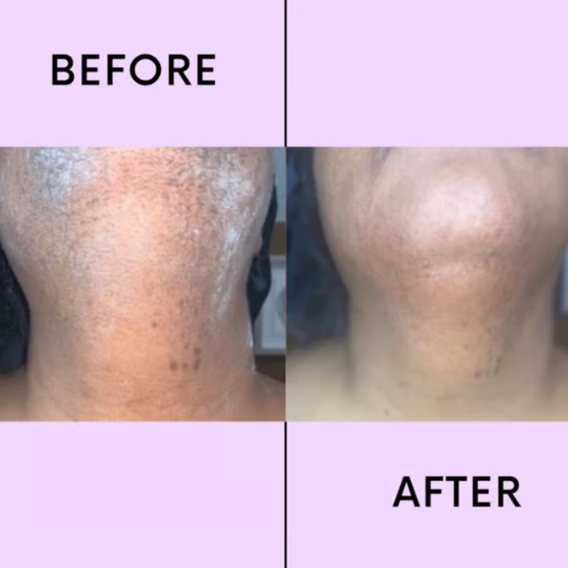 SereniSilk™ — Reveal Silky, Stubble-Free Skin That Boosts Your Confidence Instantly
