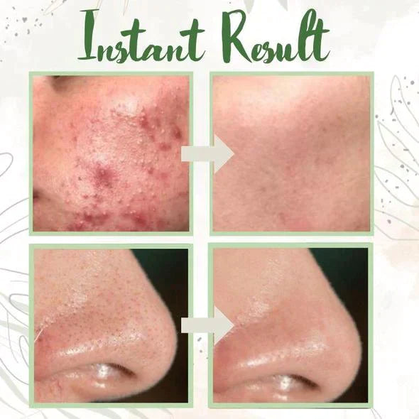 ClarifyPure™ Deep Cleanse Mask Stick — Unleash Radiant, Weightless Skin Anytime, Anywhere