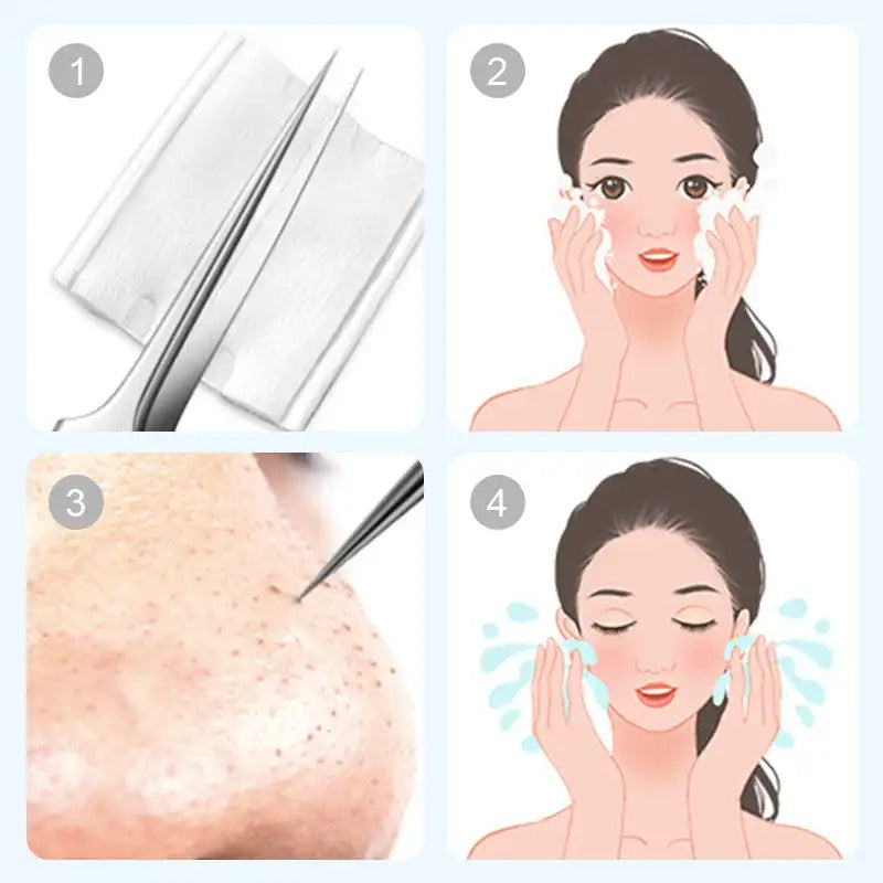 Dermaluxe™ Precision Extraction Set — Take Control with Painless, Pro-Level Clear Skin Anytime, Anywhere