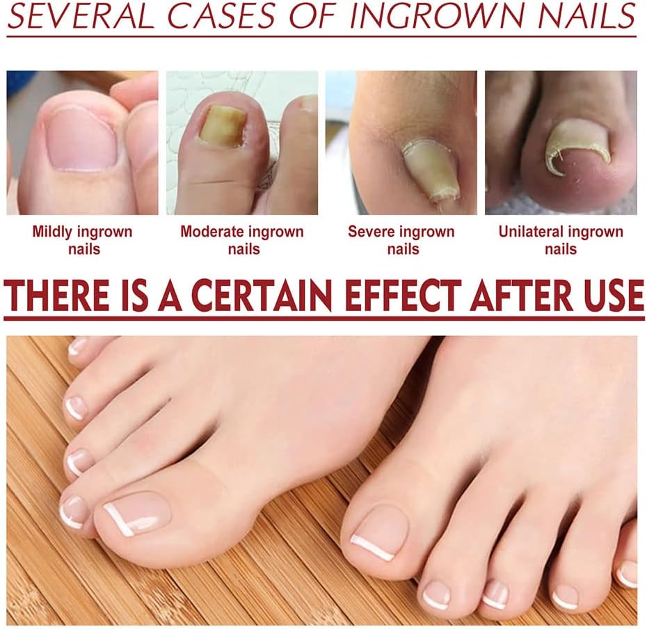 NailVita™ — Unlock Unbreakable Nails That Turn Heads Every Day