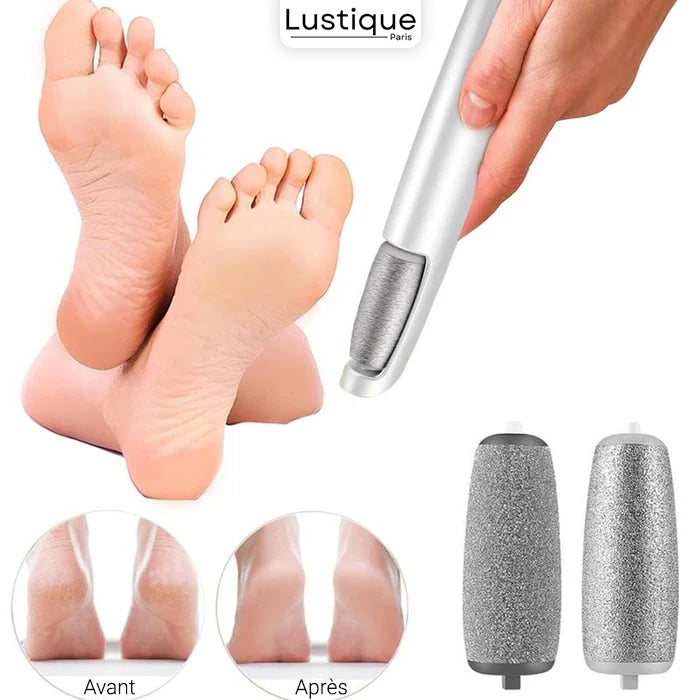VelvetStep™ — Transform Rough Feet into Silky Smooth Confidence Instantly