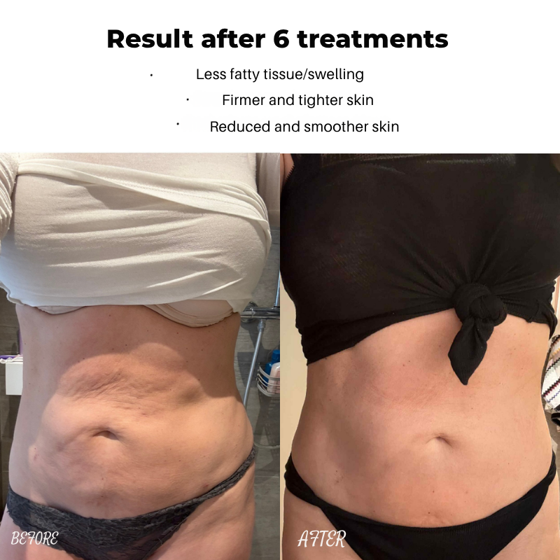 LumiVance™ — Unleash Radiant Skin That Commands Confidence Every Day