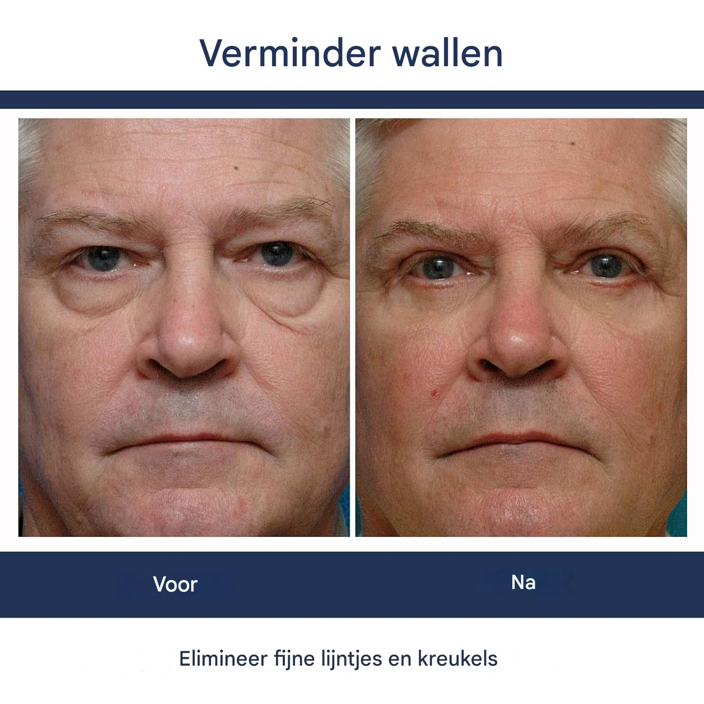 RevivaLume™ Eye Lift Gel — Wake Up Your Eyes with Instant Brightness and Youthful Confidence