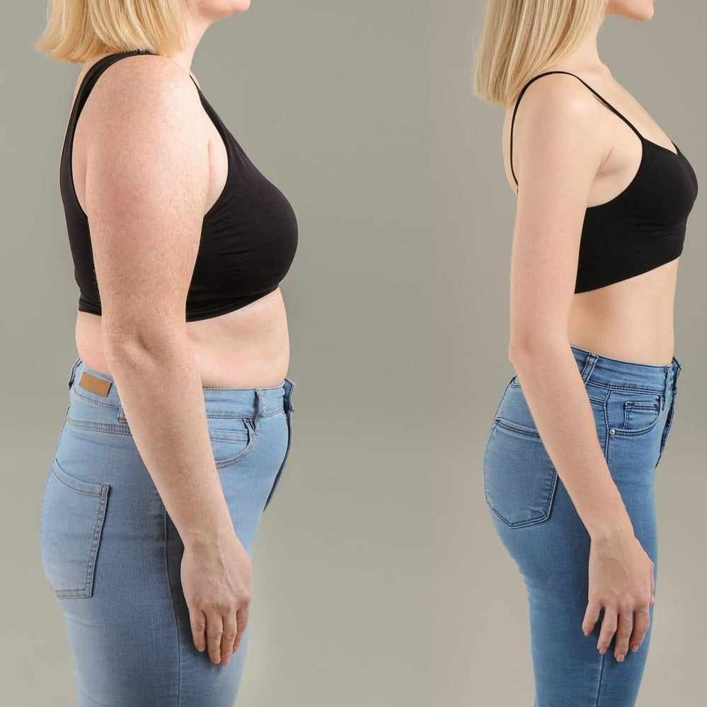 Silhoutech™ — Effortlessly Melt Fat and Reveal Radiantly Smooth, Toned Skin