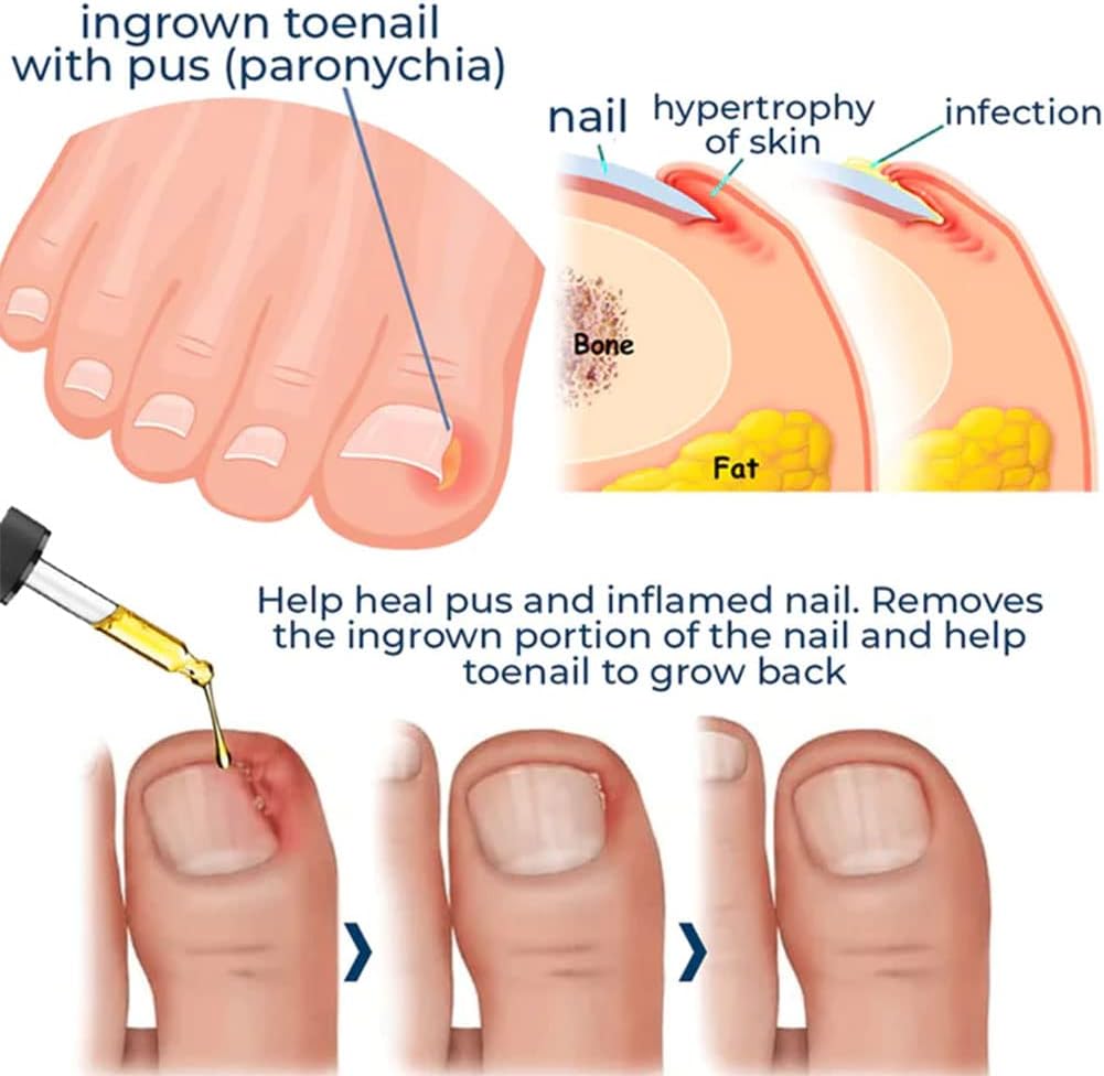 NailVita™ — Unlock Unbreakable Nails That Turn Heads Every Day