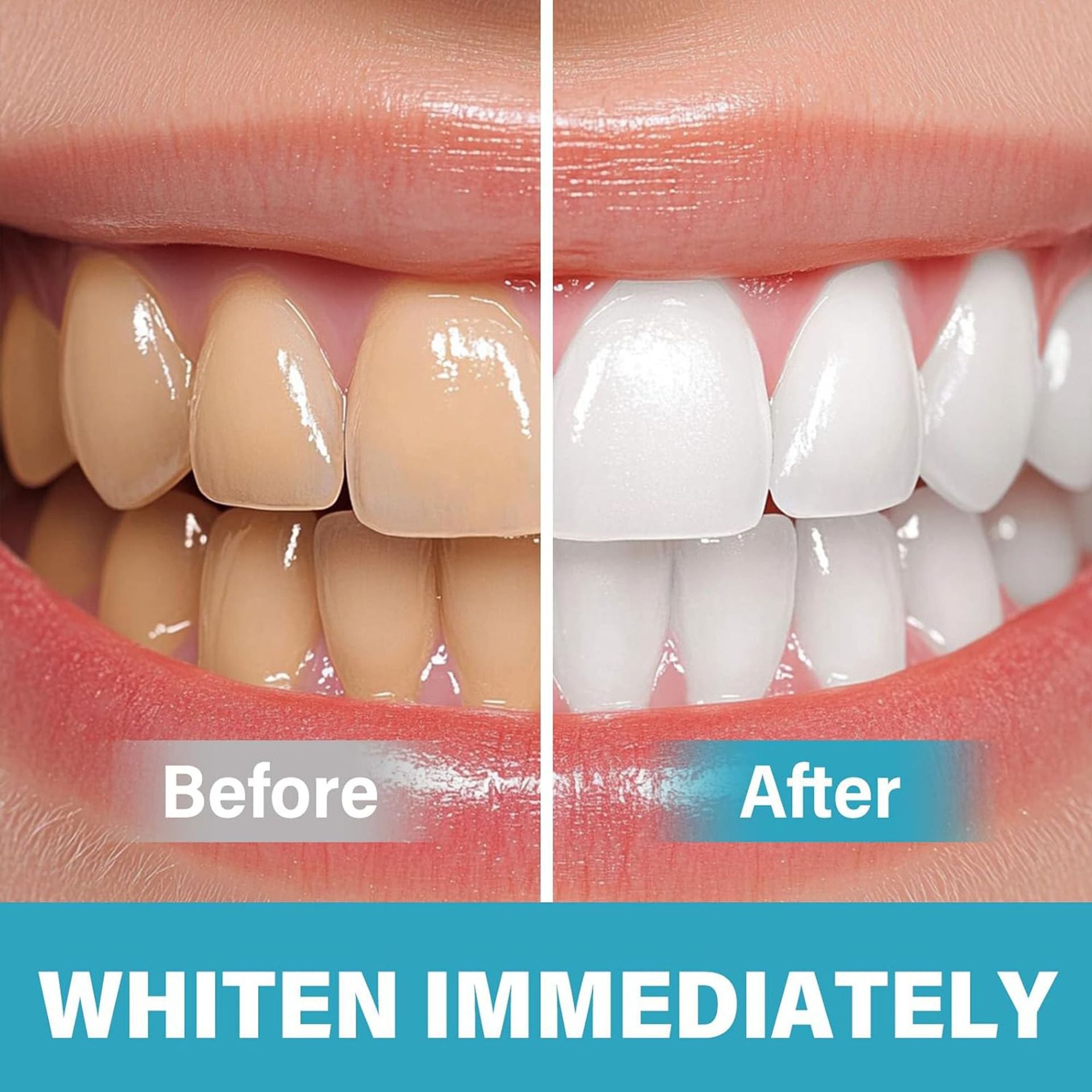 LumaShine™ — Unlock a Stunning, Pain-Free Smile That Turns Heads Instantly